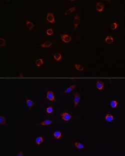 Invitrogen APLP2 Polyclonal Antibody 100 &mu;L; Unconjugated:Antibodies,
