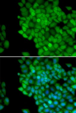 Invitrogen MAGE1 Polyclonal Antibody 100 &mu;L; Unconjugated:Antibodies,