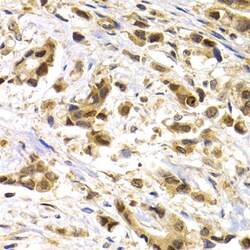 Invitrogen MAGE1 Polyclonal Antibody 100 &mu;L; Unconjugated:Antibodies,