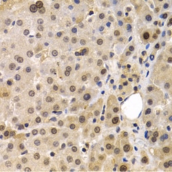 Invitrogen MAGE1 Polyclonal Antibody 100 &mu;L; Unconjugated:Antibodies,