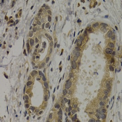 Invitrogen MAGE1 Polyclonal Antibody 100 &mu;L; Unconjugated:Antibodies,