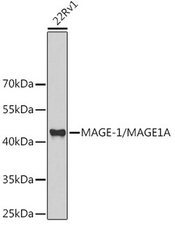 Invitrogen MAGE1 Polyclonal Antibody 100 &mu;L; Unconjugated:Antibodies,