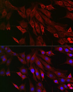 Invitrogen RMDN3 Polyclonal Antibody 100 &mu;L; Unconjugated:Antibodies,