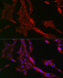 Invitrogen RMDN3 Polyclonal Antibody 100 &mu;L; Unconjugated:Antibodies,