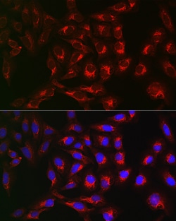 Invitrogen RMDN3 Polyclonal Antibody 100 &mu;L; Unconjugated:Antibodies,