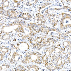 Invitrogen RMDN3 Polyclonal Antibody 100 &mu;L; Unconjugated:Antibodies,