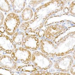 Invitrogen RMDN3 Polyclonal Antibody 100 &mu;L; Unconjugated:Antibodies,