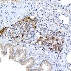 Invitrogen KMT2E Polyclonal Antibody 100 &mu;L; Unconjugated:Antibodies,