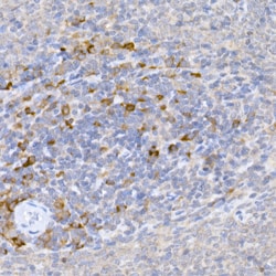 Invitrogen KMT2E Polyclonal Antibody 100 &mu;L; Unconjugated:Antibodies,