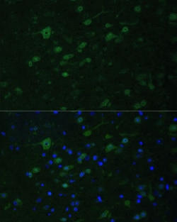 Invitrogen KMT2E Polyclonal Antibody 100 &mu;L; Unconjugated:Antibodies,