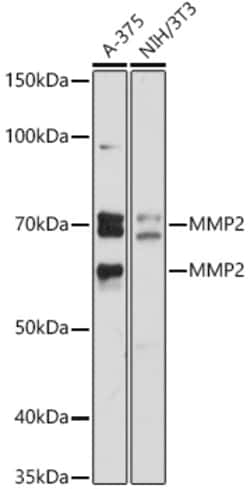 Invitrogen MMP2 Polyclonal Antibody 100 &mu;L; Unconjugated:Anticuerpos