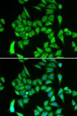 Invitrogen IREB2 Polyclonal Antibody 100 μL; Unconjugated:Antibodies,