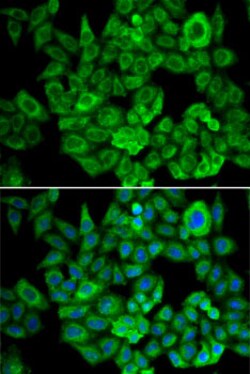 Invitrogen OGDH Polyclonal Antibody 100 &mu;L; Unconjugated:Antibodies,