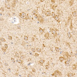 Invitrogen OGDH Polyclonal Antibody 100 &mu;L; Unconjugated:Antibodies,