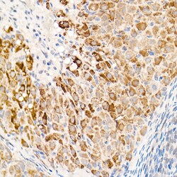 Invitrogen OGDH Polyclonal Antibody 100 &mu;L; Unconjugated:Antibodies,