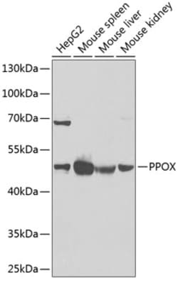 Invitrogen PPOX Polyclonal Antibody 100 &mu;L; Unconjugated:Antibodies,