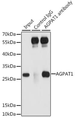 Invitrogen AGPAT1 Polyclonal Antibody 100 &mu;L; Unconjugated:Antibodies,