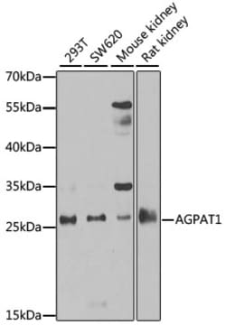 Invitrogen AGPAT1 Polyclonal Antibody 100 &mu;L; Unconjugated:Antibodies,