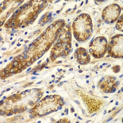 Calpain S1 Polyclonal Antibody:Antibodies, Polyclonal