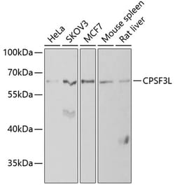 Invitrogen CPSF3L Polyclonal Antibody 100 &mu;L | Buy Online | Invitrogen&trade; | Fisher Scientific