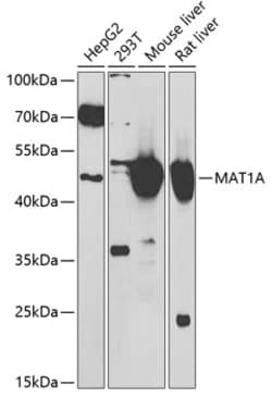 Invitrogen MAT1A Polyclonal Antibody 100 &mu;L; Unconjugated:Antibodies,