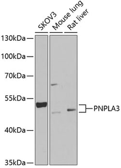 Invitrogen PNPLA3 Polyclonal Antibody 100 &mu;L; Unconjugated:Antibodies,