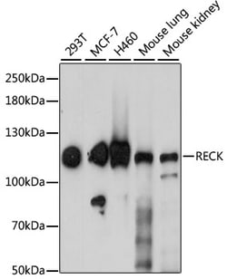 Invitrogen RECK Polyclonal Antibody 100 &mu;L; Unconjugated:Antibodies,