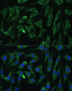 Invitrogen AGO2 Polyclonal Antibody 100 &mu;L; Unconjugated:Antibodies,