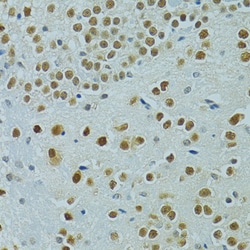 Invitrogen MUS81 Polyclonal Antibody 100 &mu;L; Unconjugated:Antibodies,