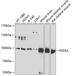 Invitrogen PDE5 Polyclonal Antibody 100 &mu;L; Unconjugated:Antibodies,