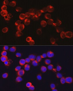 Invitrogen DEFA1 Polyclonal Antibody 100 &mu;L; Unconjugated:Antibodies,