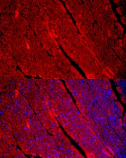 Invitrogen Myosin heavy chain 1 Polyclonal Antibody 100 &mu;L; Unconjugated:Antibodies,