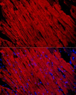 Invitrogen Myosin heavy chain 1 Polyclonal Antibody 100 &mu;L; Unconjugated:Antibodies,