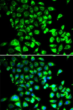 Invitrogen SSBP1 Polyclonal Antibody 100 &mu;L; Unconjugated:Antibodies,