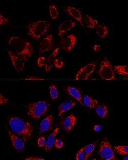 Invitrogen SSBP1 Polyclonal Antibody 100 &mu;L; Unconjugated:Antibodies,