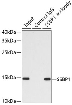 Invitrogen SSBP1 Polyclonal Antibody 100 &mu;L; Unconjugated:Antibodies,