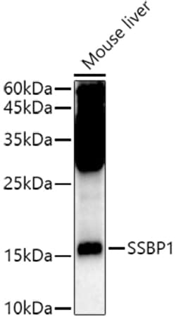 Invitrogen SSBP1 Polyclonal Antibody 100 &mu;L; Unconjugated:Antibodies,