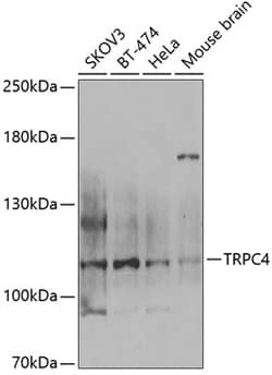 Invitrogen TRPC4 Polyclonal Antibody 100 &mu;L; Unconjugated:Antibodies,