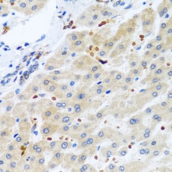 Invitrogen RGS5 Polyclonal Antibody 100 &mu;L; Unconjugated:Antibodies,