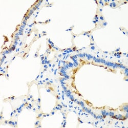 Invitrogen RGS5 Polyclonal Antibody 100 &mu;L; Unconjugated:Antibodies,