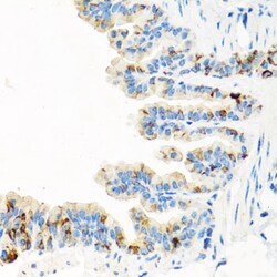 Invitrogen RGS5 Polyclonal Antibody 100 &mu;L; Unconjugated:Antibodies,