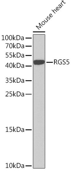 Invitrogen RGS5 Polyclonal Antibody 100 &mu;L; Unconjugated:Antibodies,