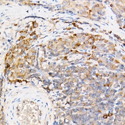 Invitrogen TES Polyclonal Antibody 100 &mu;L; Unconjugated:Antibodies,