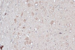 Invitrogen LC3B Polyclonal Antibody 100 μL; Unconjugated:Antibodies,