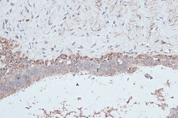 Invitrogen LC3B Polyclonal Antibody 100 μL; Unconjugated:Antibodies,
