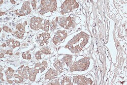 Invitrogen LC3B Polyclonal Antibody 100 μL; Unconjugated:Antibodies,