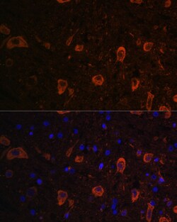 Invitrogen LC3B Polyclonal Antibody 100 μL; Unconjugated:Antibodies,