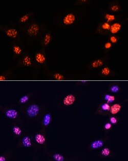 Invitrogen H3K64me3 Polyclonal Antibody 100 &mu;L; Unconjugated:Antibodies,