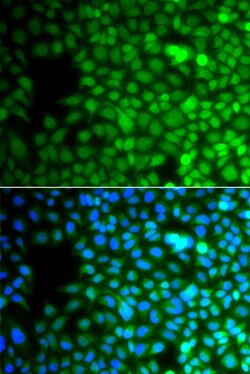 Invitrogen ZNF195 Polyclonal Antibody 100 &mu;L; Unconjugated:Antibodies,