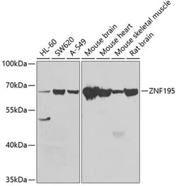 Invitrogen ZNF195 Polyclonal Antibody 100 &mu;L; Unconjugated:Antibodies,